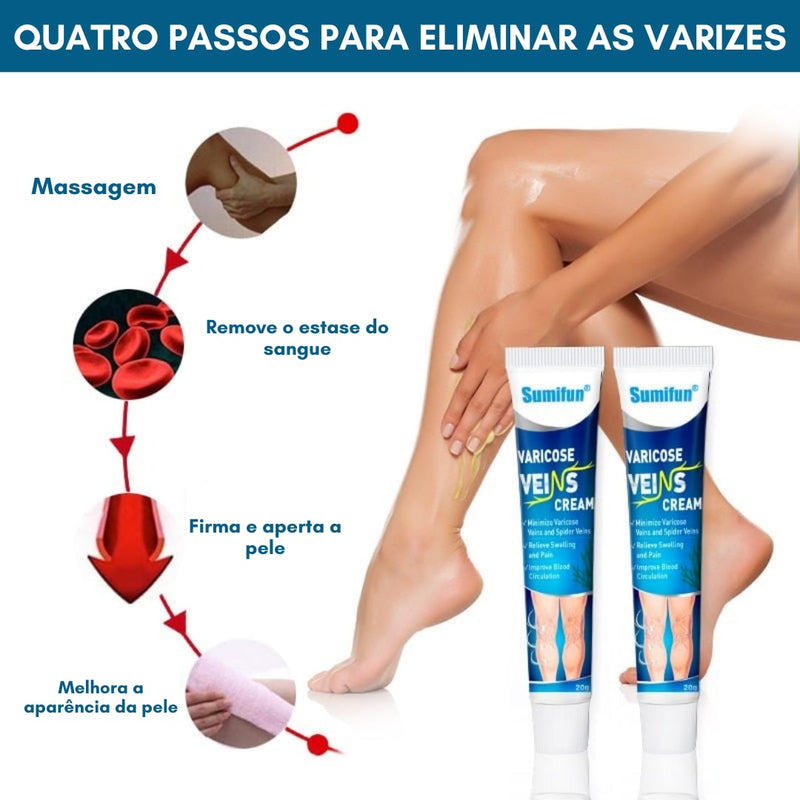 Varicose veins, Diga adeus para suas Varizes e Inchaços.