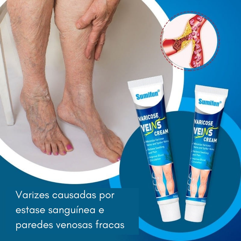 Varicose veins, Diga adeus para suas Varizes e Inchaços.