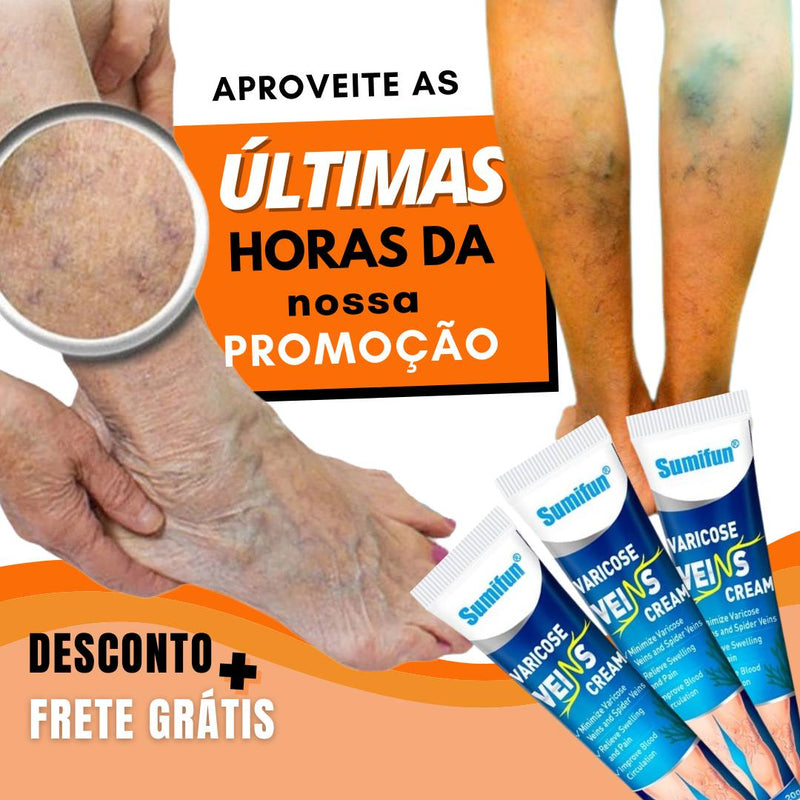 Varicose veins, Diga adeus para suas Varizes e Inchaços.